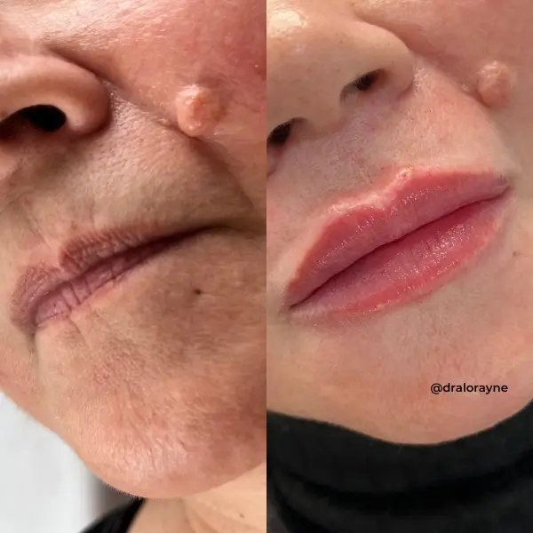 Resultado de realce facial natural